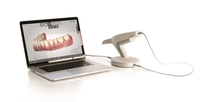 How does the 3Shape TRIOS work_ Digital Smile Design
