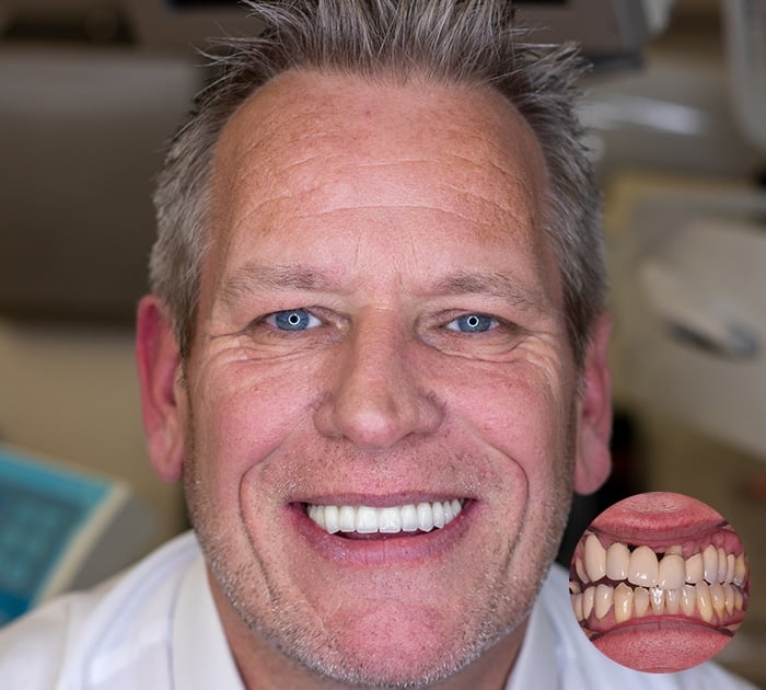 After having dental implants pay monthly treatment