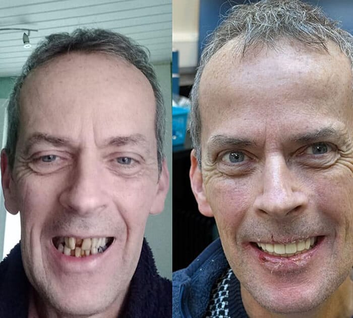after-before-ppc-images (1)