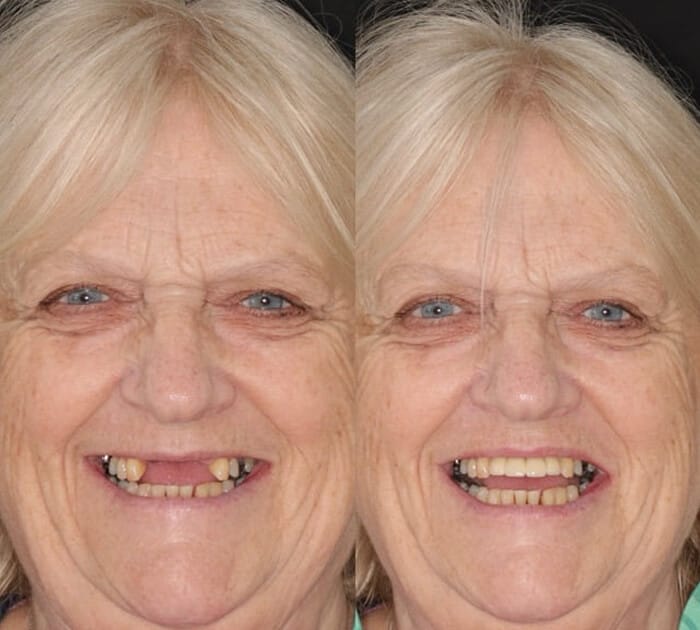 before-after-ppc-images (1)