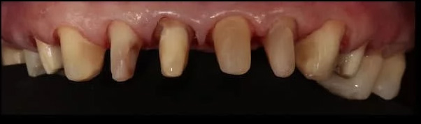 case-10 before