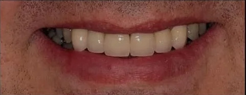 case-7 after