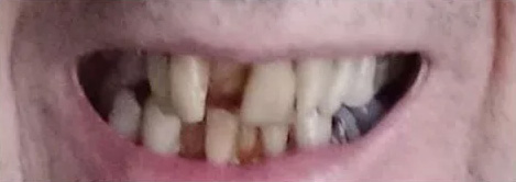 case-8 before