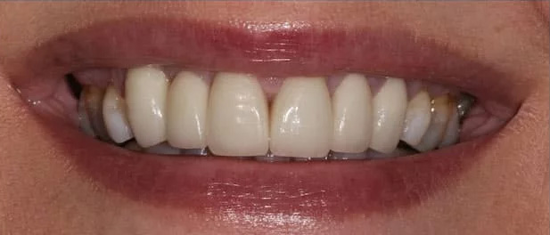 case-9 after