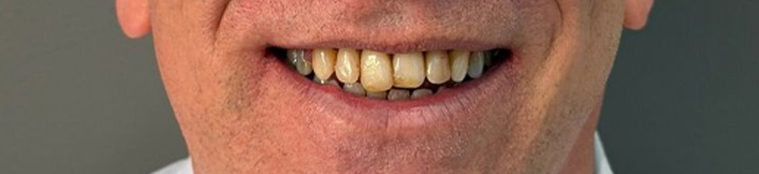 case_4 before