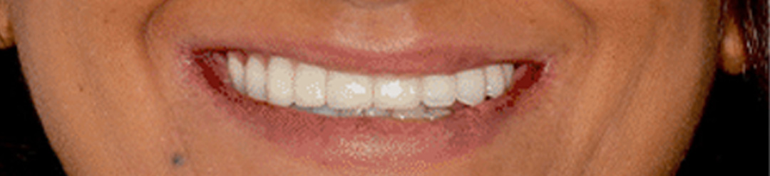 case_5 after