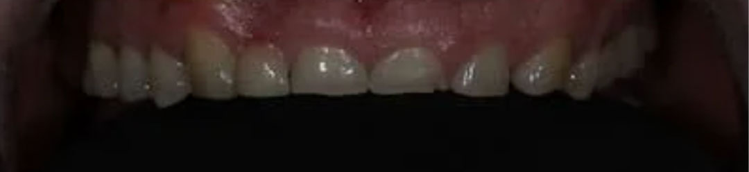 dentalimplantcentre-case-1