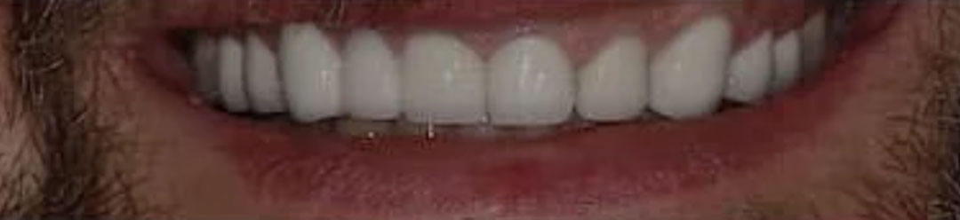 dentalimplantcentre