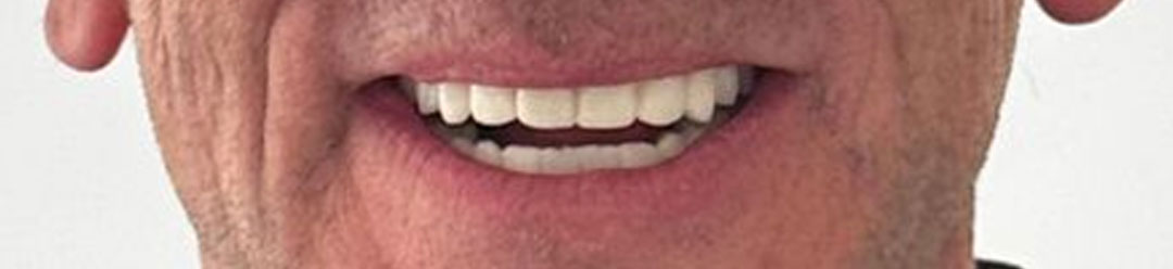 implant-dic-case-2