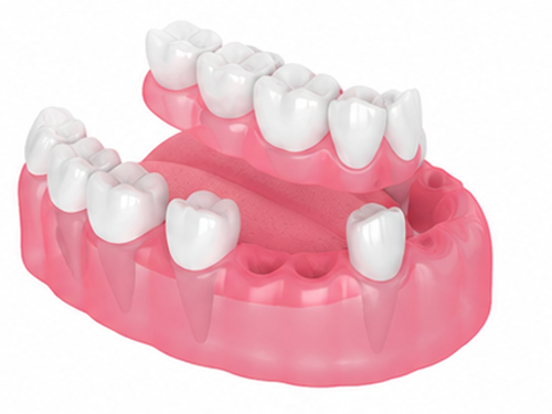 loose denture placemnet img