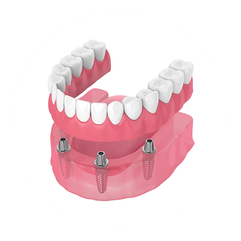 lower-or-upper-jaw-dic