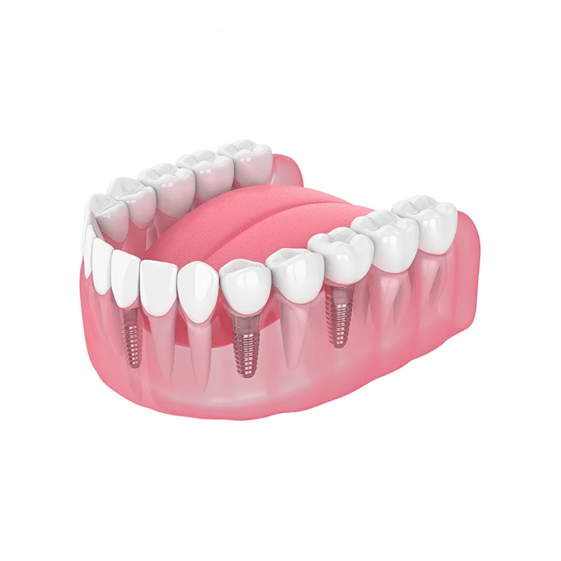 multiple-missing-teeth-dic